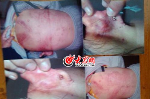 　山東藝術(shù)設(shè)計(jì)學(xué)院16歲女生宿舍內(nèi)被女同學(xué)暴打4小時(shí)。