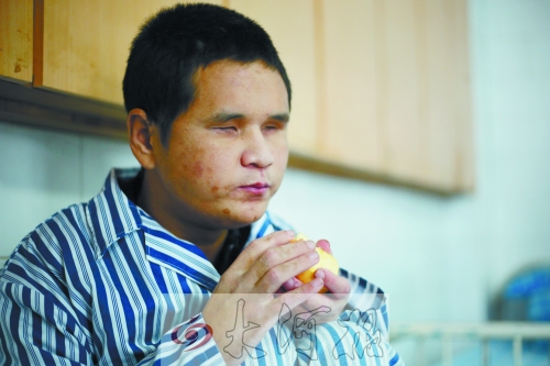 在病房里吃蘋(píng)果的程相濤看上去又白又胖