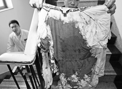 何女士的上衣被血浸透。記者楊濤攝