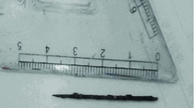 取出的繡花針已發(fā)黑生銹。