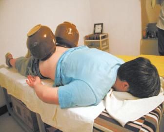 拔泡菜壇子火罐。