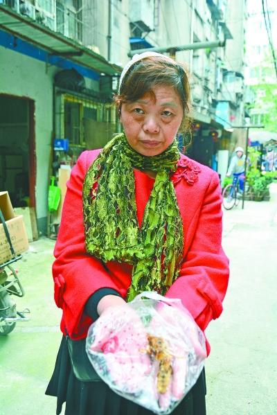 頭部受傷的黃女士展示兩根大魚刺。