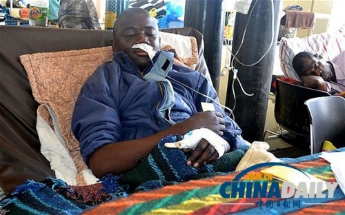 雖然已經(jīng)在醫(yī)院接受了近一個月的恢復治療，卡托卡的身體仍然非常虛弱。