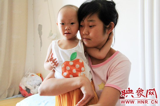 孩子和媽媽在一起，她的右眼已經失明。