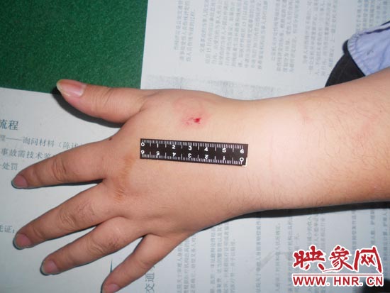 為幫助無證駕駛的朋友逃避處罰，新鄉(xiāng)的王某竟對執(zhí)勤民警大打出手，還將一名民警的手臂咬傷