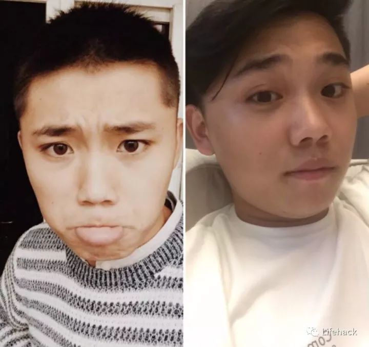 長(zhǎng)胖20斤，臉型怎么變？這些例子看完扎心了！