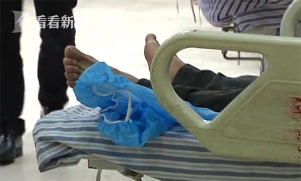 黃鱔從肛門鉆進(jìn)肚子 男子被送醫(yī)不愿多談事情經(jīng)過