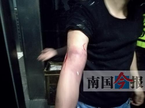 覃先生手臂被卡的部位受傷流血，所幸傷勢(shì)無(wú)大礙。 通訊員 王建民 攝