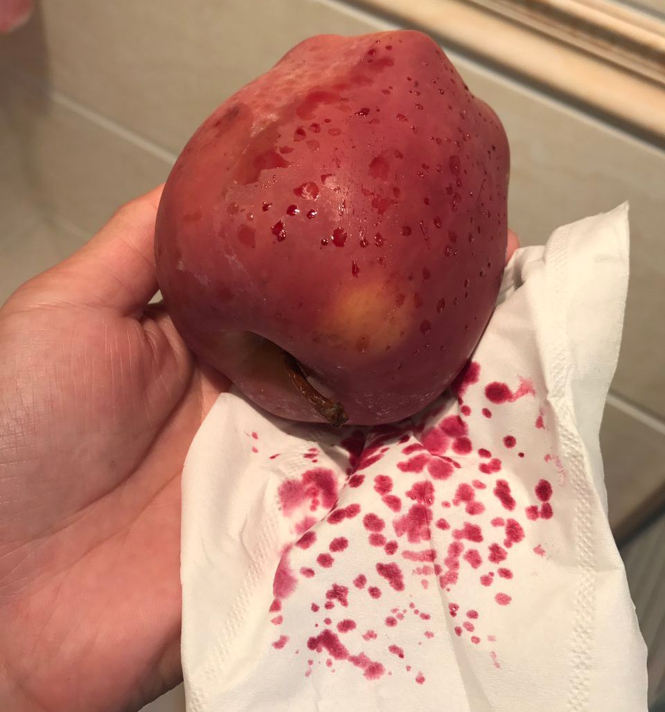 嚇懵！女子用熱水泡蘋果結(jié)果冒出血珠 咋回事？