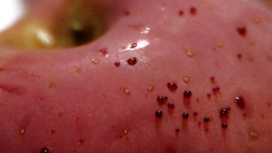 嚇懵！女子用熱水泡蘋果結(jié)果冒出血珠 咋回事？