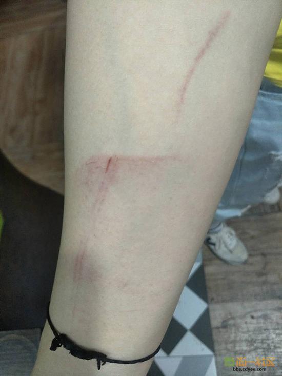 女網(wǎng)友舉報網(wǎng)帖中出示的被打后照片。