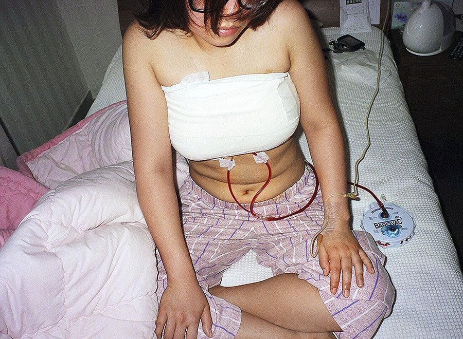 韓攝影師鏡頭記錄患者整容術(shù)后的生活 韓攝影師鏡頭記錄患者整容術(shù)后的生活