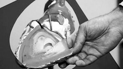 威廉斯領(lǐng)導(dǎo)的研究團(tuán)隊(duì)已經(jīng)利用人體脂肪干細(xì)胞，成功3D打印出心臟血管和心臟瓣膜，待一顆心臟的所有部件打