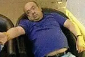 網(wǎng)傳金正男中毒后的照片。