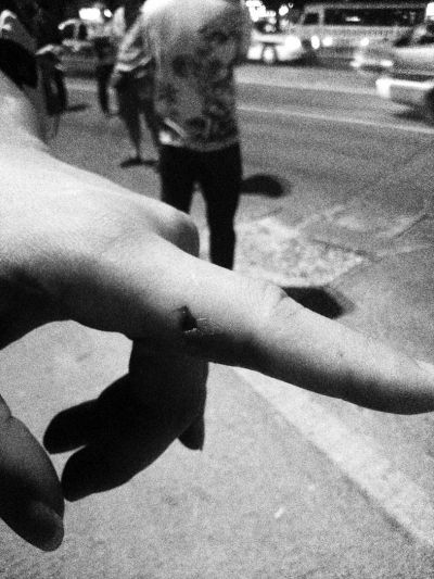 民警食指被咬傷。