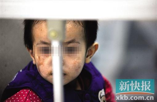 去年3月就能出院的小華(化名),目前還在廣州市婦兒醫(yī)療中心的PICU里住著。新快報(bào)記者 孫毅/攝