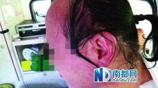 涉事教師遭熱水潑臉后的照片。