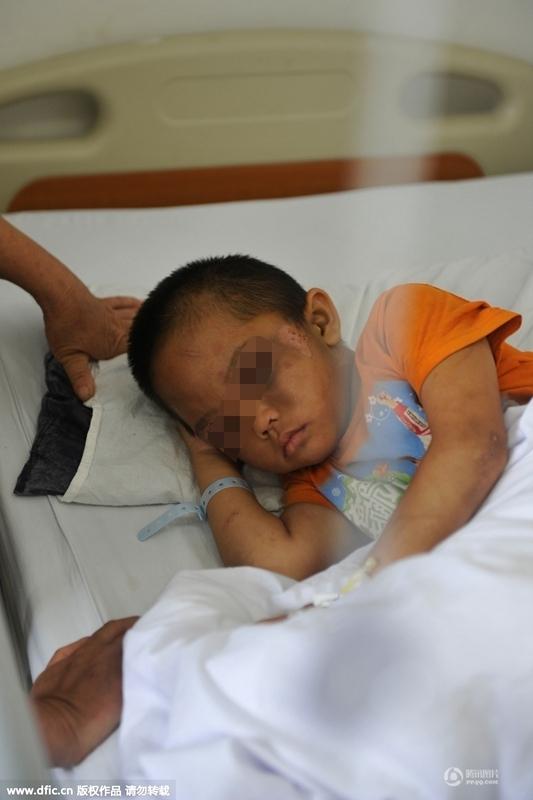 圖為全身傷痕累累的小進(jìn)。