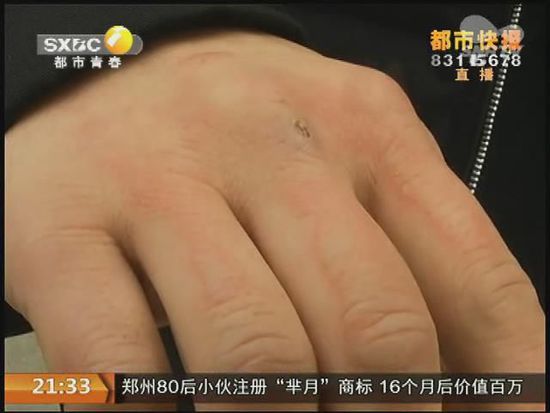 說到這足療拔罐，估計大伙都不陌生，但是想起4號晚上的拔罐的經(jīng)歷，呂先生現(xiàn)在想起來，還心有余悸。