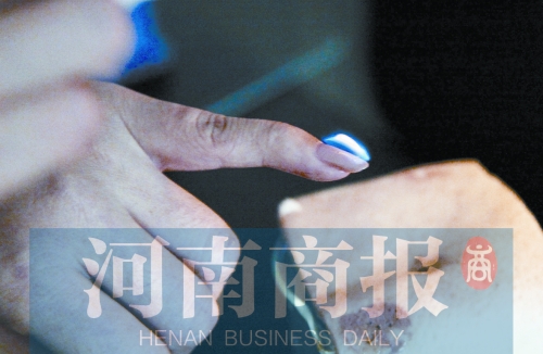 將指甲油涂在指甲上，靠近火焰時(shí)被引燃了