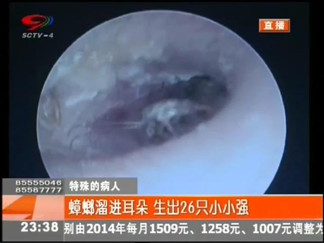 小強(qiáng)溜進(jìn)耳朵？生26只小小強(qiáng)